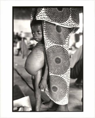 Malnourished child under mother’s dress, Ivory Coast, Africa