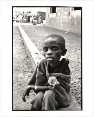 [Malnourished child, Ivory Coast, Africa]